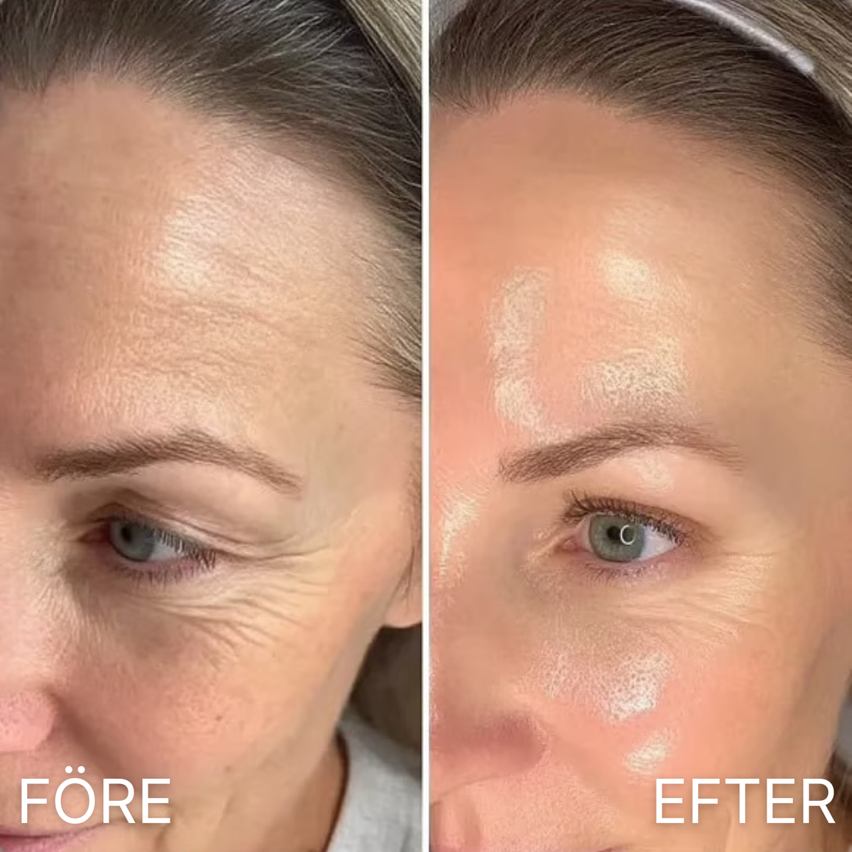 PDRN Collagen Volume Balm