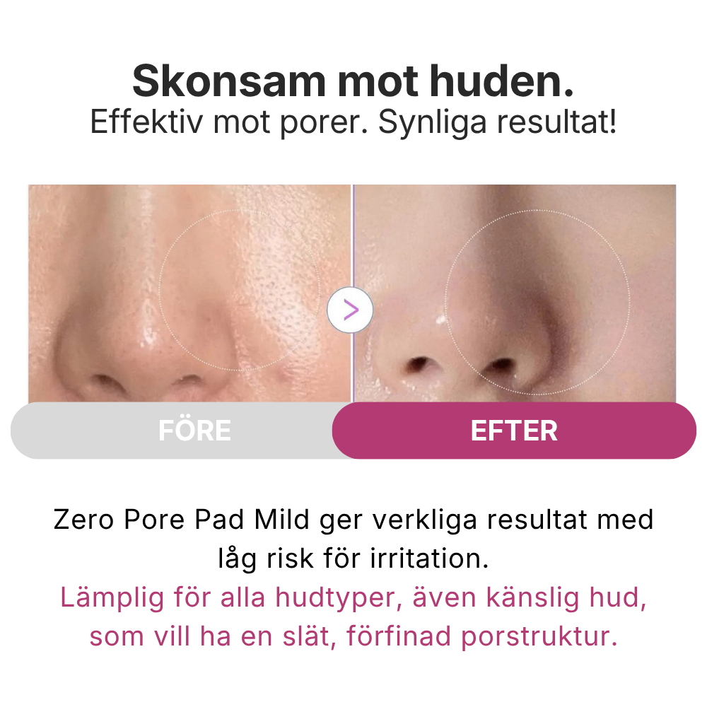Smooth & Refine Set